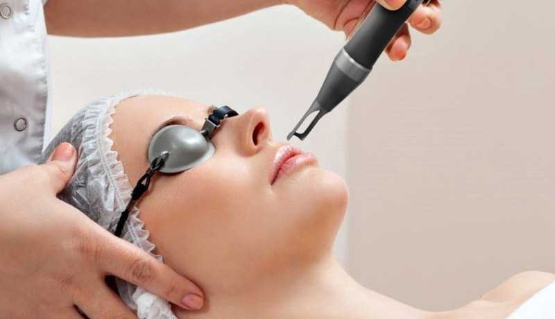 Laser Treatments