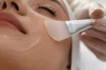 How Chemical Peels Help in Rejuvenating Your Dull and Damaged Skin